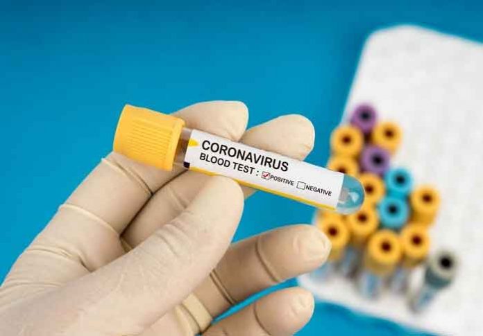 Coronavirus