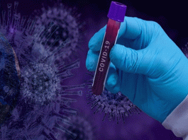 इंदौर में ‘कोविड19’ से 3785 संक्रमित, 157 मौतें Coronavirus