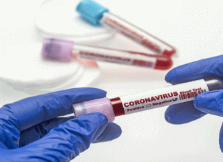 coronavirus