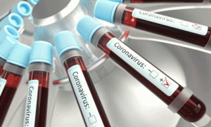 Coronas speed increases in Sangrur, government not panicked, cross 400 mark in few days