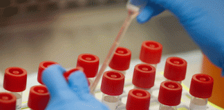 The number of corona infects in France reached 1.96 lakhs