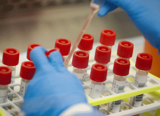The number of corona infects in France reached 1.96 lakhs