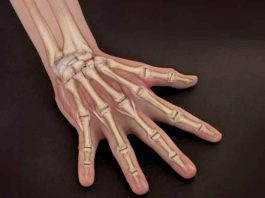 Campaign for Bone Diseases