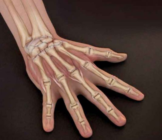 Campaign for Bone Diseases