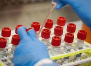Corona infection records 24,879 cases in country, number of infected crosses 7.67 lakh