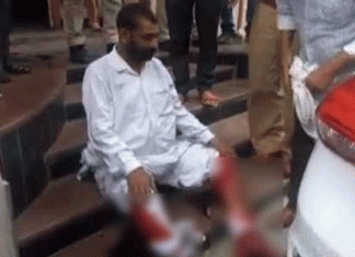 Middle aged attempted suicide, cut the veins of legs