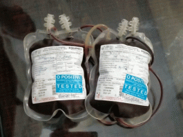 Due to negligence of health department, patient felt blood after 4 days