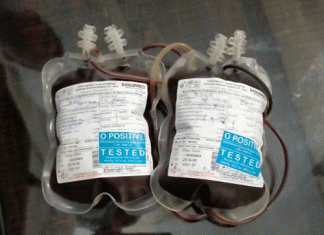Due to negligence of health department, patient felt blood after 4 days