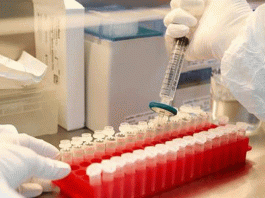 देश में अब तक साढ़े आठ करोड़ से ज्यादा नमूनों का परीक्षण हुआ’ Corona Samples