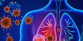 Survive from Pneumonia During the Covid-19 Pandemic Period