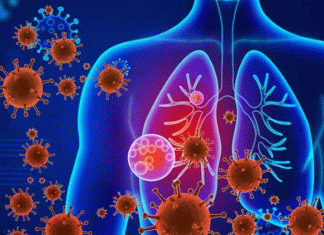 Survive from Pneumonia During the Covid-19 Pandemic Period