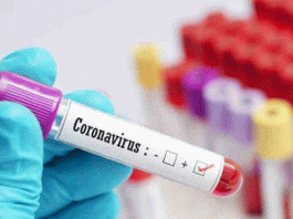 जिला में रविवार को मिला कोरोना संक्रमण का एक मामला Coronavirus