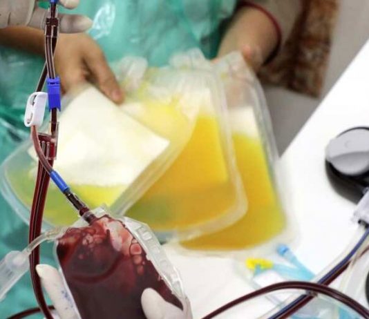 Plasma Therapy