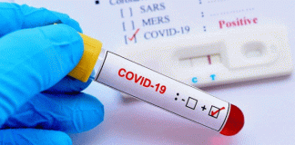 20 positives including staff-students found in Jawahar Navodaya Vidyalaya