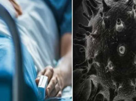 Bhiwani black fungus