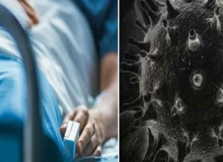 Bhiwani black fungus