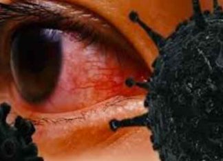 सरसा में ब्लैक फंगस दो नए मामले आए सामने Black-fungus-sirsa sachkahoon