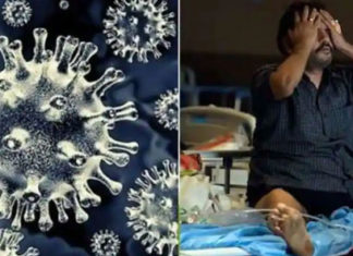 black fungus in Delhi