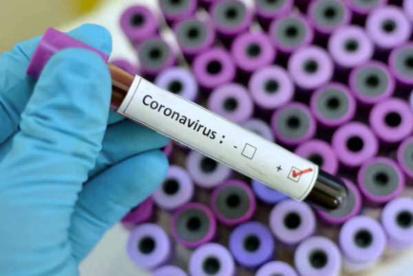 coronavirus-sirsa sachkahoon