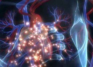 Heart disease sachkahoon