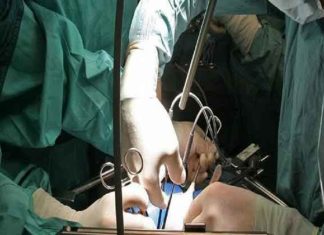 Hospital removed kidney SACHKAHOON
