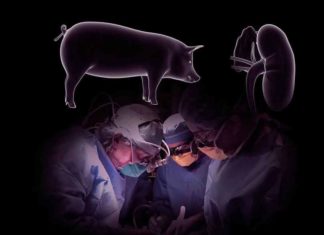 मानव शरीर में सुअर की किडनी का सफल ट्रांसप्लांट, अमेरिकी डॉक्टरों को मिली सफलता pig kidney in the human body sachkahoon