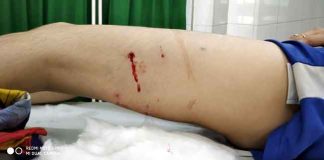 Student Injured sachkahoon