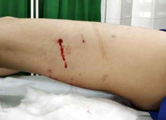 Student Injured sachkahoon