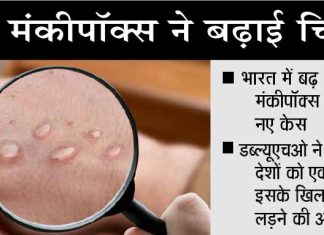 मंकीपॉक्स के विकास को समझने के लिए और अध्ययन की जरूरत: विशेषज्ञ Monkeypox