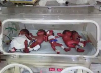 Woman Birth Five Children