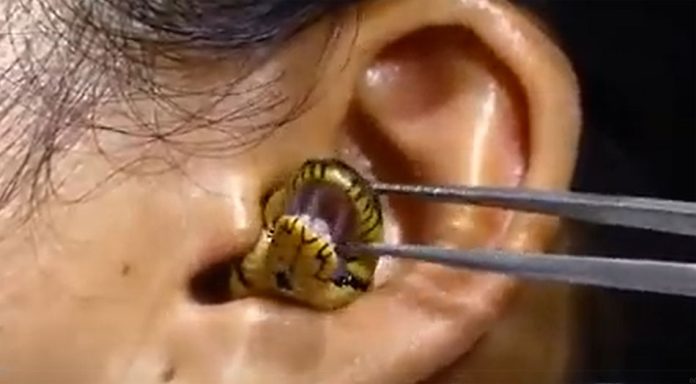 Snake in Girl Ear