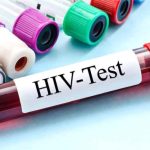 HIV Positive
