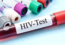 HIV Positive
