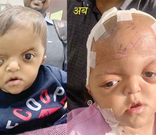 गर्भ में ही विचित्र बीमारी से ग्रस्त बच्चे के लिए फरिश्ता बने डॉक्टर