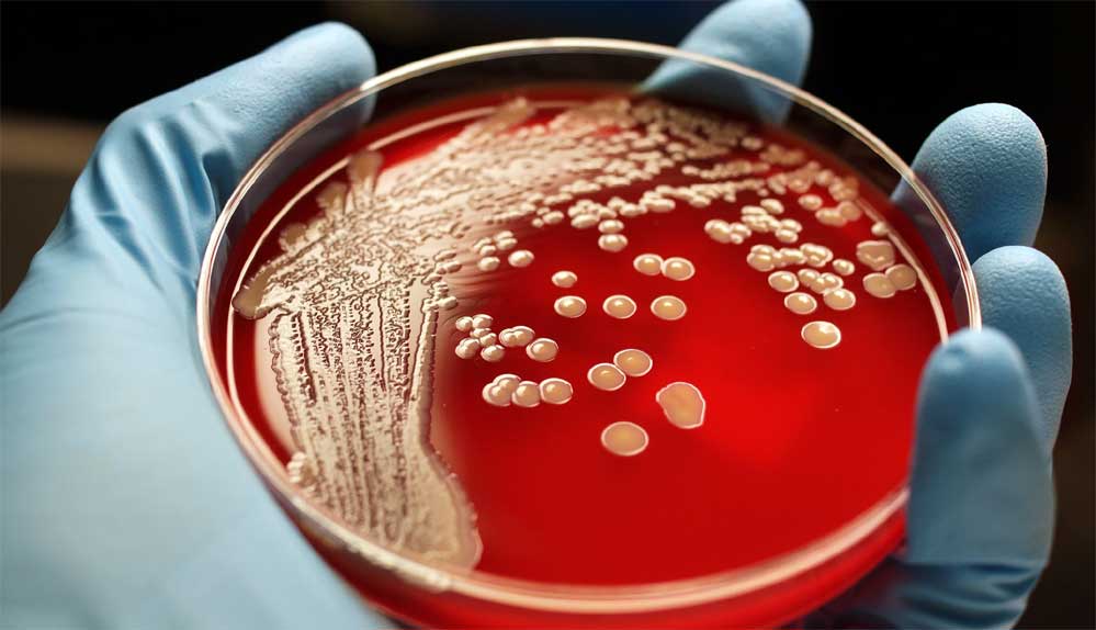 Superbug Bacteria
