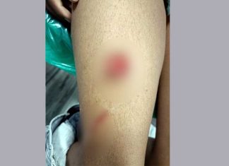 अबोहर में कुत्तों का आंतक जारी Abohar News