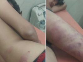 युवक को बेल्ट से बांधकर बेरहमी से पीटा, वीडियो वायरल karina