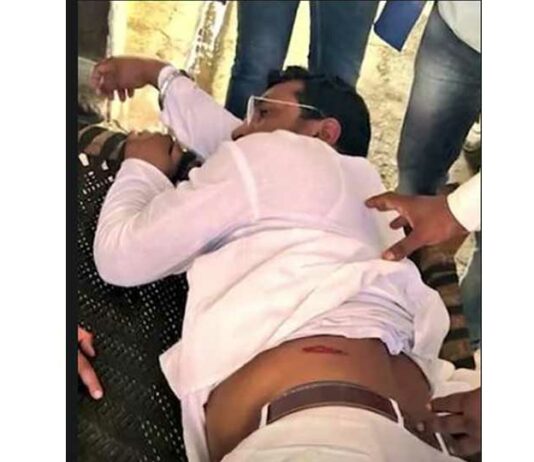 Chandrashekhar Azad Attacked
