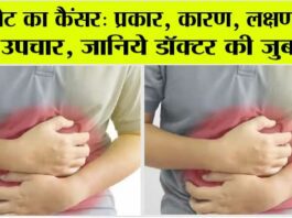 Stomach Cancer