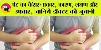 Stomach Cancer