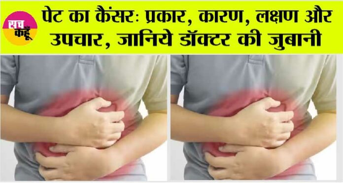 Stomach Cancer