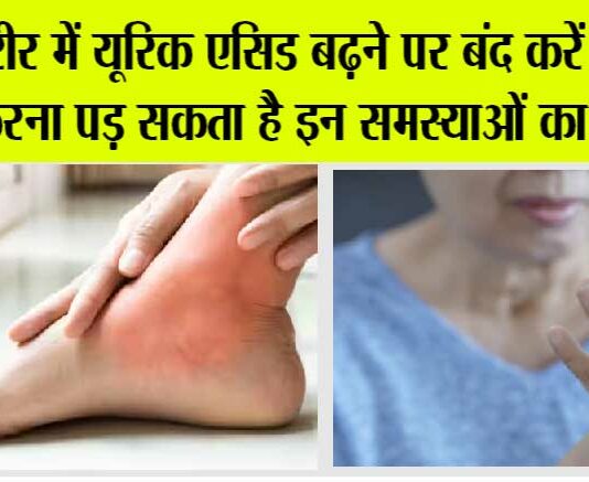 Uric Acid