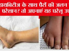 Diabetic Foot Irritation