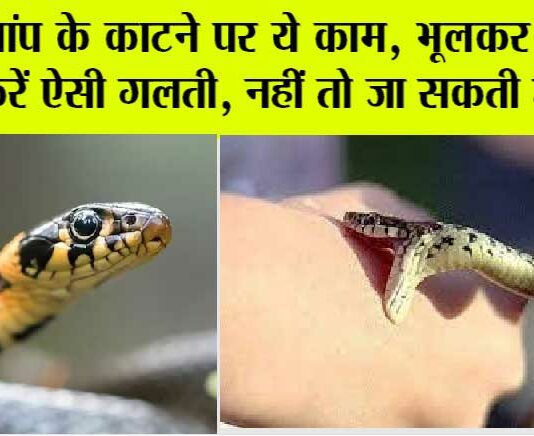 Snake Bite: सांप के काटने पर ये काम, भूलकर भी ना करें ऐसी गलती, नहीं तो जा सकती है जान Snake Bite