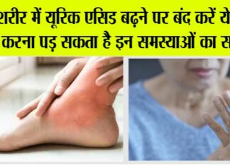 Diet Tips For Uric Acid
