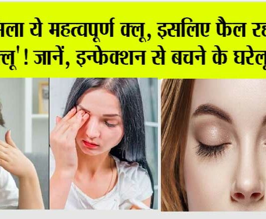 Eye Flu Home Remedy