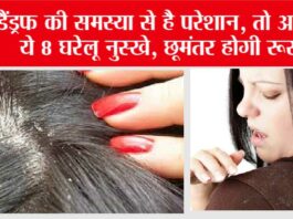 Get Rid Of Dandruff