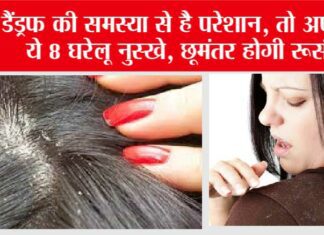 Get Rid Of Dandruff