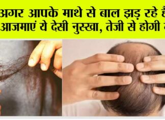 Hair Fall: अगर आपके माथे से बाल झड़ रहे हैं तो आजमाएं ये देसी नुस्खा, तेजी से आएंगे बाल Hair Fall