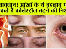 High Cholesterol Symptoms